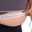 Obesity