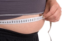 Obesity