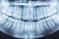 Panoramic Xray