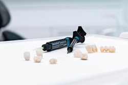 The Variolink Esthetic DC. Image courtesy of the Ivoclar Group.