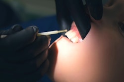 Fluoride Application Closeup