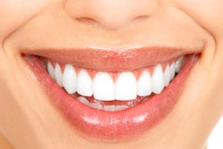 Smile3