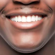 Veneers Man