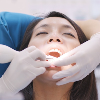 Dental Scaling Woman 400