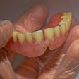 Denture Broken