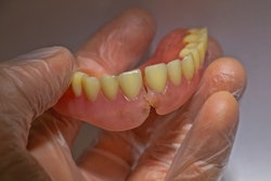Denture Broken