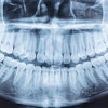 Panoramic Xray Res