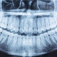 Panoramic Xray Res