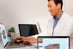 The iTero Design Suite enables clinicians to design an in-practice 3D printing of models, bite splints, and restorations, leveraging its exocad CAD/CAM software with simplified doctor and staff-friendly design applications. Image courtesy of Align Technology Inc.