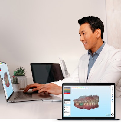 The iTero Design Suite enables clinicians to design an in-practice 3D printing of models, bite splints, and restorations, leveraging its exocad CAD/CAM software with simplified doctor and staff-friendly design applications. Image courtesy of Align Technology Inc.