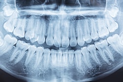 Panoramic Xray