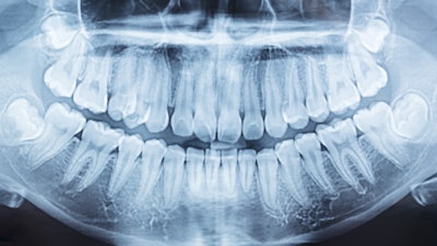 Panoramic Xray