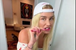 Kesha. Image courtesy of PopBase/X.