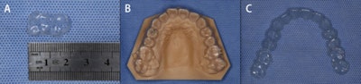 Fractured pieces of the orthodontic invisible aligner. (A) The 2-cm swallowed piece of the aligner. (B) Fractured pieces of the whole aligner on the 3D-printed model. (C) Fractured pieces of the whole aligner.