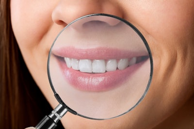 Teeth Magnifying Glass