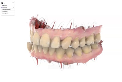 Perceptive's OCT imaging system uses infrared light to render detailed images that are three times more accurate than x-rays, according to Perceptive. Images courtesy of Perceptive.