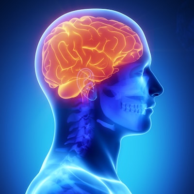 Brain General