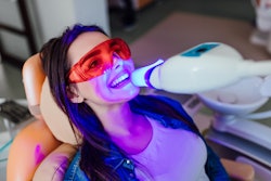 Teeth Whitening Woman