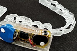 2024 11 14 Mouth Io 400