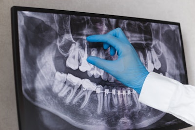 Dental X Ray