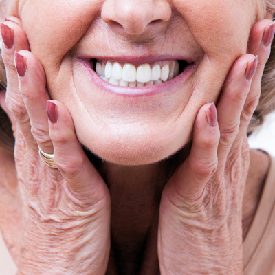 Dentures Woman Smiling 400