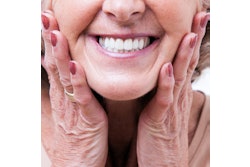 Dentures Woman Smiling 400