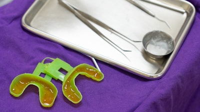 Fluoride Mouth Guard