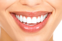 Smile3