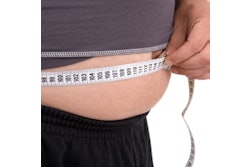 Obesity 400