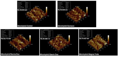 Microhybrid composite groups. The first group is the control group. The other groups are AFM images after 28 days of experimentation with GL, GD, RDc and MF antacid syrups, respectively. Images and captions courtesy of Öcal and Dayi. Licensed under CC BY ND 4.0.