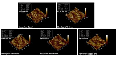 Nanohybrid composite groups. The first group is the control group. The other groups are AFM images after 28 days of experimentation with GL, GD, RD, and MF antacid syrups, respectively.