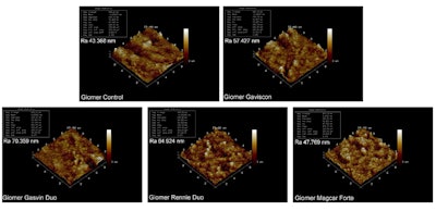 Giomer composite groups. The first group is the control group. The other groups are AFM images after 28 days of experimentation with GL, GD, RD, and MF antacid syrups, respectively.