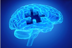 Brain Puzzle Dementia