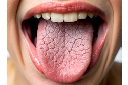 Dry Mouth ольга