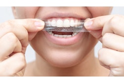 Teeth Whitening Strip марина демешко