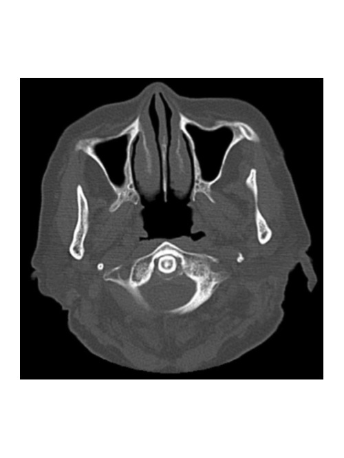 2025 02 11 Crowded Dens Syndrome Thumbnail