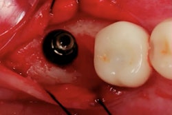 2025 02 26 Cdocs Bone Profiling 400