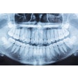 Panoramic Xray