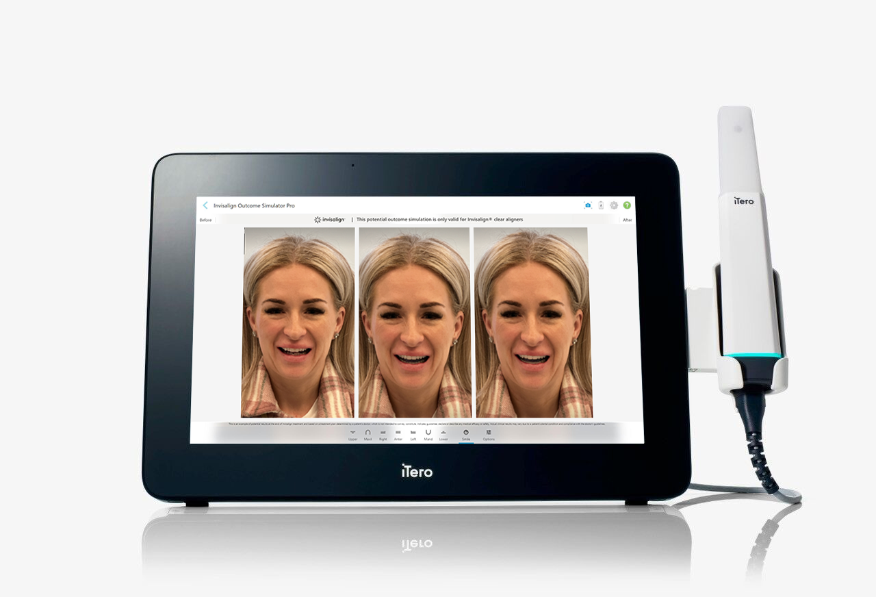 iTero Lumina displayed at IDS in Cologne, Germany