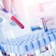 Blood Test Samples Lab