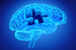 Brain Puzzle Dementia