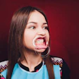 Dental Mouth Retractor Gag