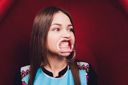 Dental Mouth Retractor Gag