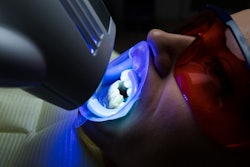 Teeth Whitening Led F8 Suport Ukraine