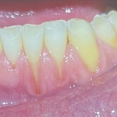 2025 04 14 Clear Defense