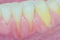 2025 04 14 Clear Defense