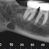 Figure 2: Reformatted and cropped panoramic film.