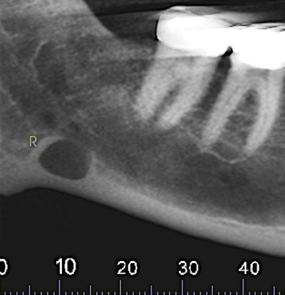 Figure 2: Reformatted and cropped panoramic film.