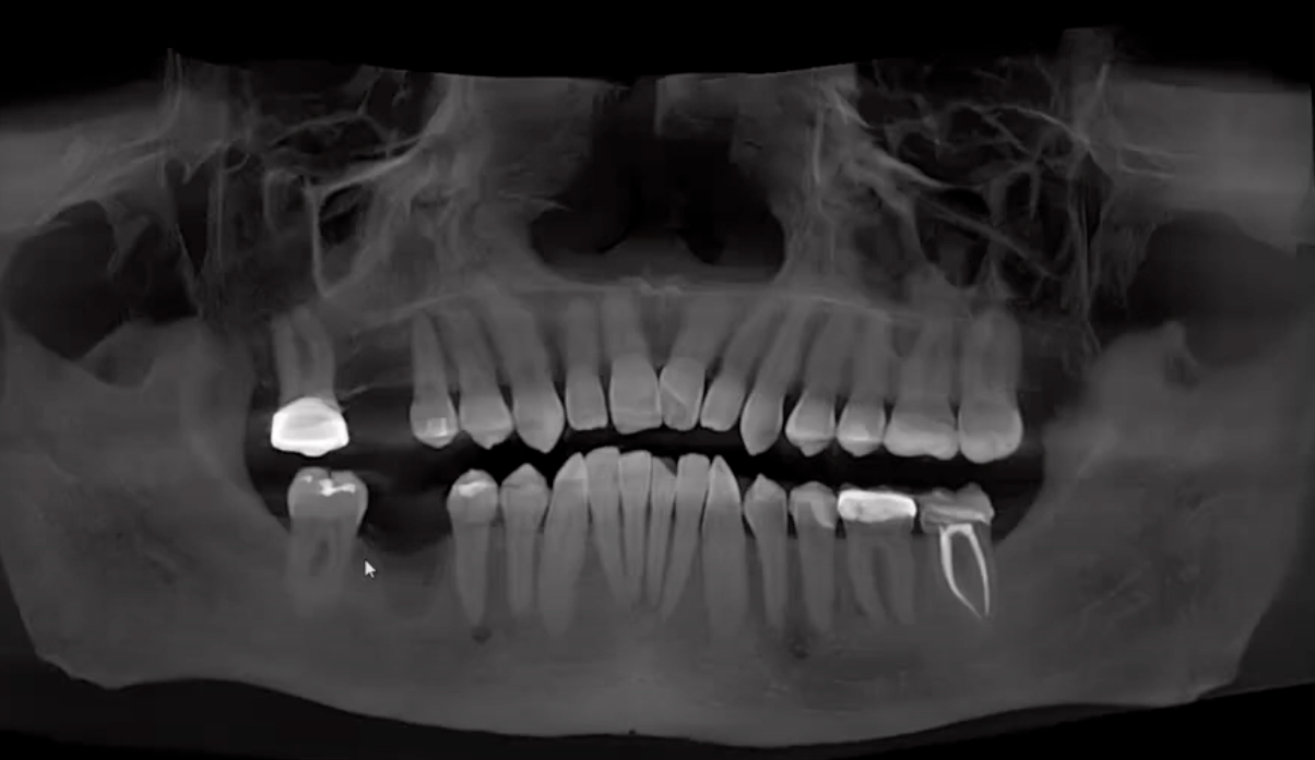 Using CBCT for better case presentation