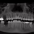 Using CBCT for better case presentation